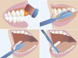 Como Cepillar Los Dientes Correctamente Clinica Dental Ruiz Y Cobo Dentista Ubeda Y Baeza Clinicas Ruiz Y Cobo En Ubeda Y Baeza