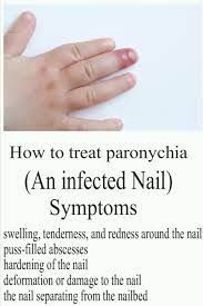 Tips For Nail And Tongue Health Tips Healthy Natural Magazine Hangnail Treatment Essential Oil For Infection Tongue Health