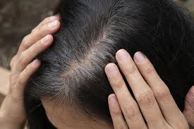 Ribbed gourd too helps in the restoration of hair pigment in the scalp and helps grey hair to turn black naturally. 343 561 Gray Hair Photos Free Royalty Free Stock Photos From Dreamstime