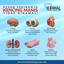 Kencing manis yang bergantung kepada insulin. Bolehkah Pesakit Kencing Manis Sihat Semula Bagaimanakah Cara Menurunkan Bacaan Gula Dalam Darah