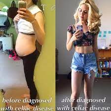 We did not find results for: Pin On Gluten Free Diet