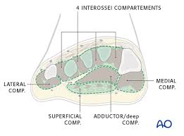 Add your reflection on what you learned from this page and how it relates to your practice: Compartment Syndrome