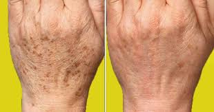 Denenecek Projeler Panosundaki Pin