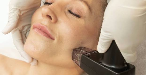 Morpheus8 in Dubai | RF Microneedling for Skin Tightening