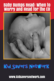 Baby Bumps Head When To Worry Head For The Er Infographic Baby Bumped Head Baby Bumps New Parents