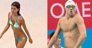 When pectus excavatum is severe, the condition can cause symptoms such as chest pain, lung problems and difficulty breathing. 38 Celebrities With Pectus Excavatum Life With Pectus