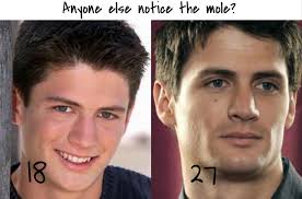 James Lafferty (Nathan Scott) OTH anyone else notice the mole? It wasn't  there season 1, but it definitely started getting darker over the 9 seasons  the show aired for.