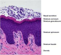 4 gateways to the nasal cavity. Localization Of Staphylococcus Aureus In Tissue From The Nasal Vestibule In Healthy Carriers Bmc Microbiology Full Text