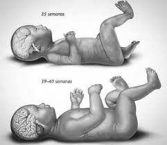 Manual De Mama Latina Piensas Que Es Mejor Una Cesarea Programada Donde Casi Siempre Es A Las 38 Semanas Incluso Antes Aqui La Importancia De Un Embarazo A Termino Por Que