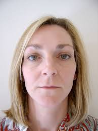 AGELESS BEAUTY THROUGH LIP AUGMENTATION by Lois W. Stern