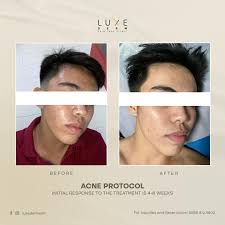 Luxe Derm Skin Care Clinic