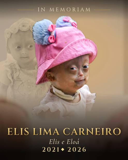 Elis Lima Carneiro, one of the twins behind Elis e Eloá| Guilherme, died on  September 30, 2026, at 5 years old. Her family announced it on the page she  shared with her