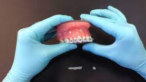 Maybe you would like to learn more about one of these? How To Use Orthodontic Wax Youtube