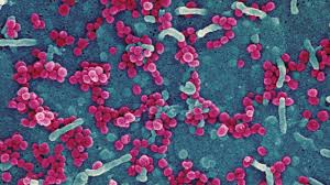 Image result for Lassa Fever
