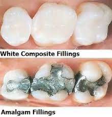 Pin On Dental Facts