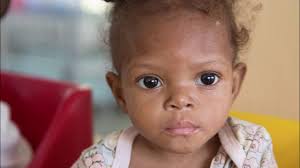 "Soleil" (Ayiti Ke Ou Bat Fo') by Angelo Rose