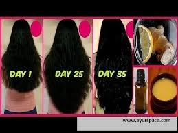 I am originally from kolkata and recently shifted to bangalore for job purpose. Pin On Hair Growth