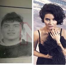 Jun 04, 2021 · toplumda sık görülen omurga eğriliği yani skolyoz, hareket kabiliyetini ciddi ölçüde kısıtlayarak yaşam kalitesini düşürebiliyor. Meger Estetik Guzeliymis Nesrin Cavadzade Nin Eski Fotografi Sasirtti Foto Galerisi