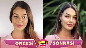 Dilan çiçek deniz'in göğüslerini de silikon yaptırdığı son dönemde konuşuluyordu. Alev Alev Oyunculari Oncesi Sonrasi Eski Halleri Cihangir Ceyhan Dilan Cicek Deniz Youtube