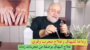 Na druhé straně pracujeme se dvěma vyšetřovacími verzemi, říká zeman. Ø§Ù„Ø¨Ù‡Ø§Ù‚ ÙˆØ¹Ù„Ø§Ø¬Ù‡ Ø§Ù„Ù†Ù‡Ø§Ø¦ÙŠ ÙˆØ§Ù„Ù…Ø¬Ø±Ø¨ Ù…Ù† Ù…Ø¬Ø±Ø¨Ø§Øª Ø²Ù…Ø§Ù† Youtube