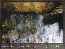 الحكمة الطب النبوي ماء زمزم