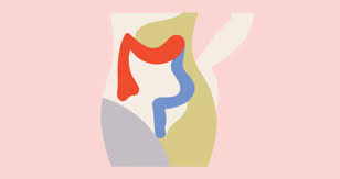 Both haemorrhoids and colorectal cancer can cause rectal bleeding. A Mother S Bowel Cancer Was Misdiagnosed As Heartburn And Hemorrhoids The Importance Of Advocating For Your Health Survivornet