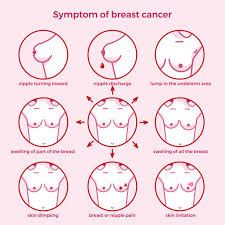 If you think your breast cancer was misdiagnosed as a result of malpractice, consider scheduling a free consultation with a lawyer who specializes in medical malpractice cases. Healthy Motherhood Keeping Breast Cancer At Bay Life Confluence