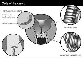 Abnormal pap smear results can be worrisome, at least until a second pap smear reveals more information. An Unsatisfactory Result Cancer Institute Nsw