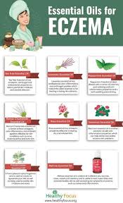 Essential Oils For Eczema Infographic In 2020 Oils For Eczema Essential Oils For Eczema Oils For Skin