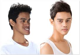 699 likes · 19 talking. Cara Hilangkan Kesan Syabu 12 Petua Menghilangkan Parut Dengan Efektif Tanpa Produk