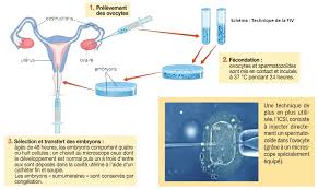 Activite 3 L Infertilite Et L Aide A La Procreation Les Svt Avec Db
