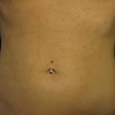 Pin On Rash