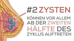 Vorzeitige wechseljahre setzen vor dem 40. Wechseljahre Symptome Die Ersten Anzeichen