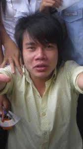 Được biết, đây là vợ của nam diễn viên hài lê dương bảo lâm, người này cũng thường xuyên livestream bán hàng phụ vợ trên facebook chính. Hanh Trinh Dao Keo Ä'au Ä'á»›n Cá»§a Le DÆ°Æ¡ng Báº£o Lam Cháº¥p Nháº­n Pháº«u Thuáº­t 10 Ngay Láº§n 3 Phen CÆ°a RÄƒng Theo Trend