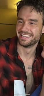 I am confused where has his birth mark gone in these photo as it clear in  the photo of him in white top ? Not hate please just wondering as it's not