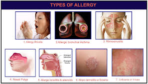 Not only are the symptoms removed, the growths themselves vanish over a period of time. 6 Best Homeopathic Medicines For Allergic Rhinitis Treatment