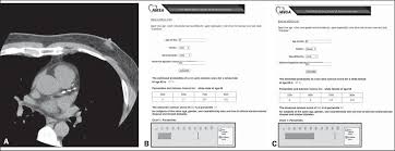 Coronary Artery Calcium Score Current Status