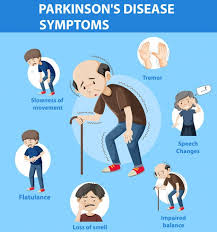 Some are hard for even doctors to detect. Parkinson S Stages Symptoms Treatment Parkinson S Foundation