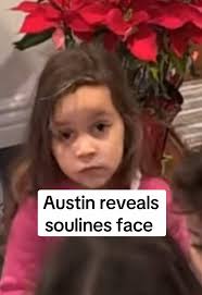 Austin McBroom Reveals Soulines Face