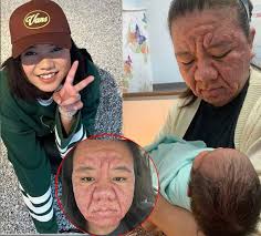 When baby Michelle was born, the room went silent. 22 years later she looks  INCREDIBLE! Check the comments 👇