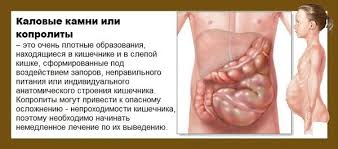 Kak Pochistit Kishechnik Ot Kalovyh Mass Bystrye Sposoby Oficialnyj Sajt Gbuz Rodilnyj Dom 2 G Magnitogorsk