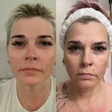 This just in: #HaileyBieber has officially sold her skin care brand,  @rhode, to e.l.f. Beauty in a groundbreaking $1 billion deal. “I found a  like-minded disruptor with a vision to be a