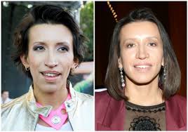 Некоторые результаты до и после интимных пластических операций, манипуляций контурной пластики гениталий препаратами гиалуроновой кислоты, а также процедур по косметологии интимной зоны у женщин. Togda I Sejchas Uchastnicy Shou Comedy Woman Teleport