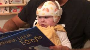 Most Expensive Drug In The World Saves Life Of Child With Rare Disease Part 2 Video Abc News