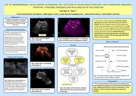 Sensation of incomplete evacuation after a bowel movement. Eposters Use Of Transabdominal Color Doppler Ultrasound For Detection Of Colon Cancer In Patients With Nonspecific Abdominal Symptoms A Personal Experience And Meta Analysis Of The Literature