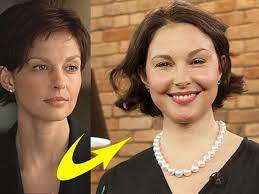 The media had a field day over allegations that ashley judd had gone under the surgeon's knife. Wtf Happened To Ashley Judd S Face Swollen Cheeks Spark Plastic Surgery Rumours 9celebrity