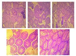 Image result for Buchholzia