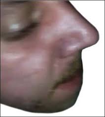 Diane Alvarez (@alvarezd77)