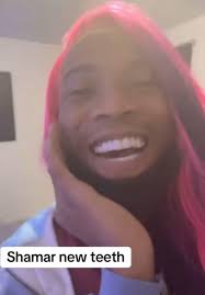 Shamar partnered up with zeus to get his teeth done 😁🥺❤️ he deserves  this‼️ Videos in comments
