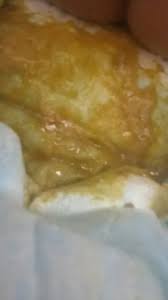 Mi Bebe Hace Popo Amarilla Y Aguada Kumpulan Berbagai Skripsi